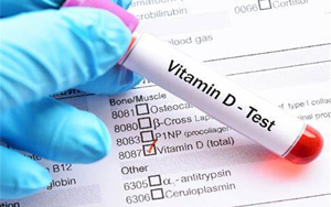 25-羥基維生素D-磁微粒化學發(fā)光法（AE/AP） /熒光免疫層析解決方案（雙抗體夾心法）