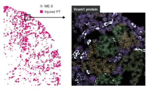 解密腎臟微環(huán)境對腎損傷有哪些影響