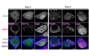 科學(xué)家發(fā)現(xiàn)了引發(fā)帕金森病的隱藏RNA結(jié)構(gòu)