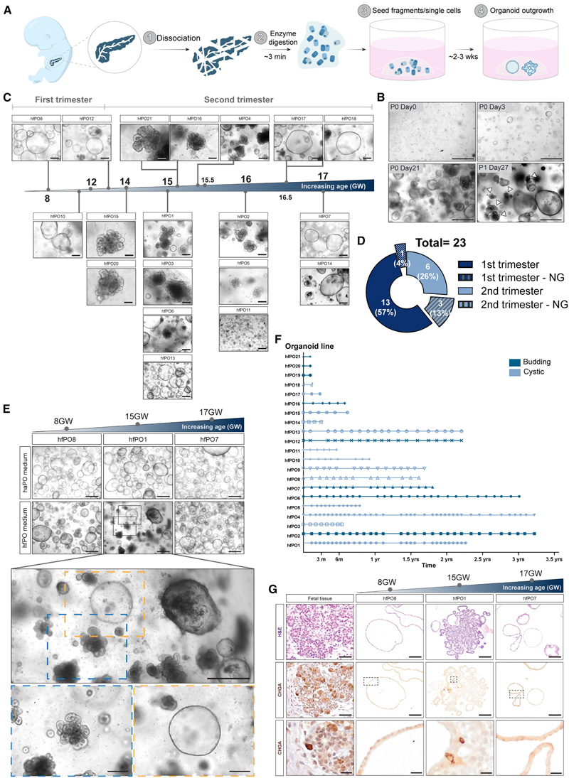 人胎兒胰腺類器官的建立 人胎兒胰腺類器官的建立