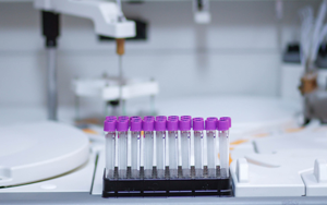 轉(zhuǎn)染試劑小白入門指南