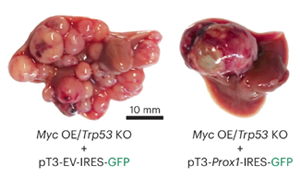 《Nature Genetics》PROX1積極抑制細(xì)胞命運(yùn)可塑性，保護(hù)肝細(xì)胞身份，防止肝腫瘤發(fā)生