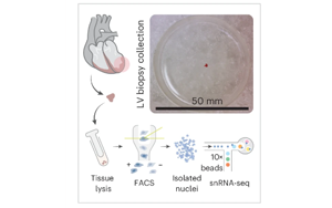 Nature Cardiovascular Research：心臟炎癥的關(guān)鍵差異