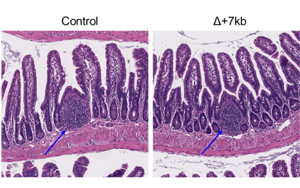 Nature：科學家新發(fā)現(xiàn)一種免疫細胞類型，與過敏有關