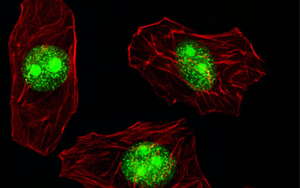 細胞表面的RNA結合蛋白是對抗癌癥的關鍵