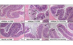 ALOX15功能人源化通過(guò)提升RvD5生成緩解小鼠結(jié)腸炎但不影響足爪水腫的機(jī)制研究