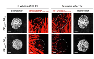 胰島微環(huán)境影響1型糖尿病發(fā)展的機制研究：基于BioBreeding大鼠模型及apoCIII靶向干預策略