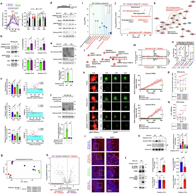 胰島素激活的ATM調(diào)控小腦中需氧糖酵解的關(guān)鍵調(diào)控因子