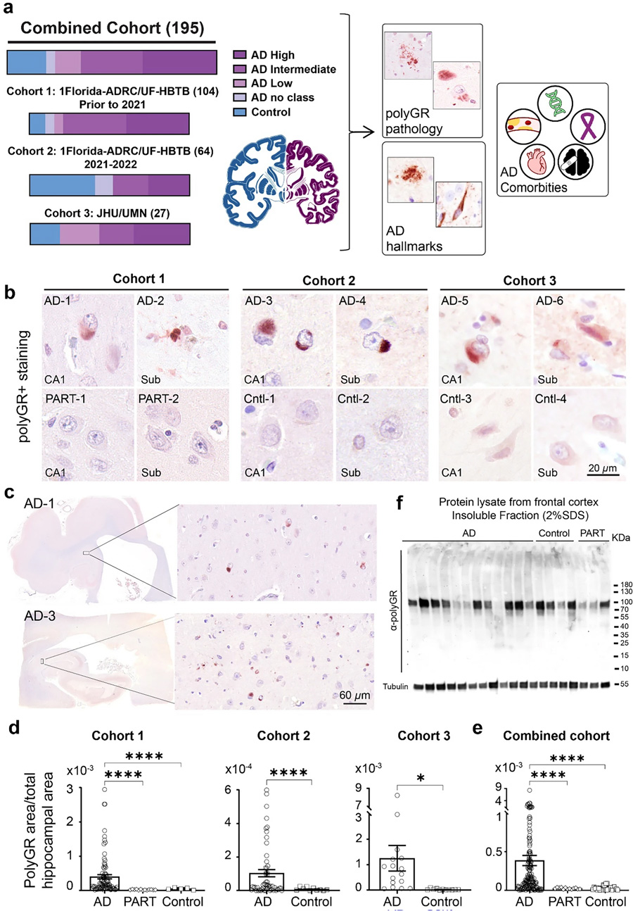 在多組阿爾茨海默病尸檢腦樣本中，海馬體頻繁檢測到PolyGR+?蛋白聚集物
