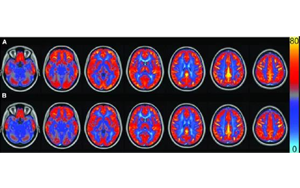 AJCN：要長(zhǎng)壽，常吃豆！長(zhǎng)期食用大豆飲食可讓大腦“更靈光”
