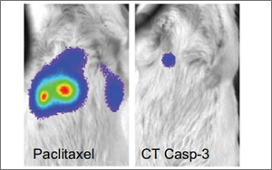 Nature子刊：用細菌遞送藥物到癌細胞內(nèi)，有效治療肝癌和乳腺癌