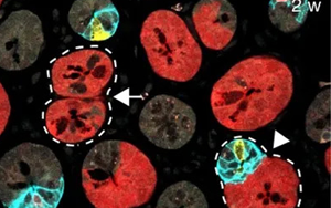 Nature 三連重磅！識破癌細(xì)胞的“詭計(jì)”，為結(jié)直腸癌患者帶來新希望