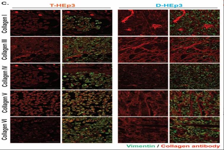 讓癌細胞“一睡不醒”！向腫瘤微環(huán)境中添加III型膠原蛋白可防止腫瘤復發(fā)和轉移