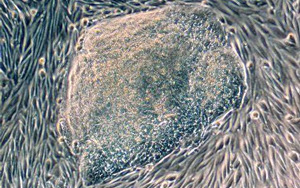 首次發(fā)現(xiàn)人類尿液來源的干細(xì)胞具有強(qiáng)大的再生潛力！