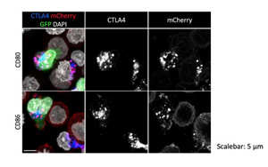 一種開創(chuàng)性的基因編輯技術(shù)可以修復(fù)免疫系統(tǒng)關(guān)鍵細(xì)胞缺陷