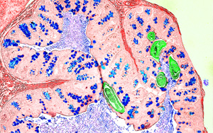 Nature新研究解答爭(zhēng)議，為炎癥性疾病的免疫機(jī)制提供新見解