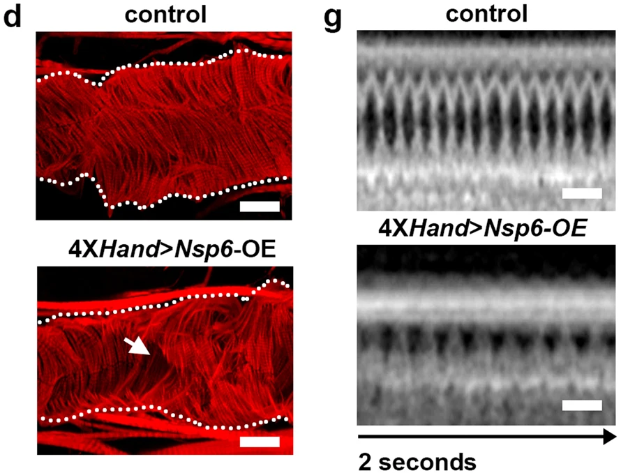 UAS-SARS-CoV-2Nsp6轉(zhuǎn)基因的4XH和Gal4、成纖維細(xì)胞特異性過(guò)表達(dá)（OE）誘導(dǎo)的成人心臟表型