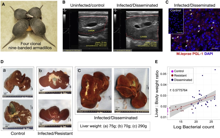 麻風分枝桿菌促進成年九帶犰狳體內(nèi)正常肝臟器官生長而無肝損傷