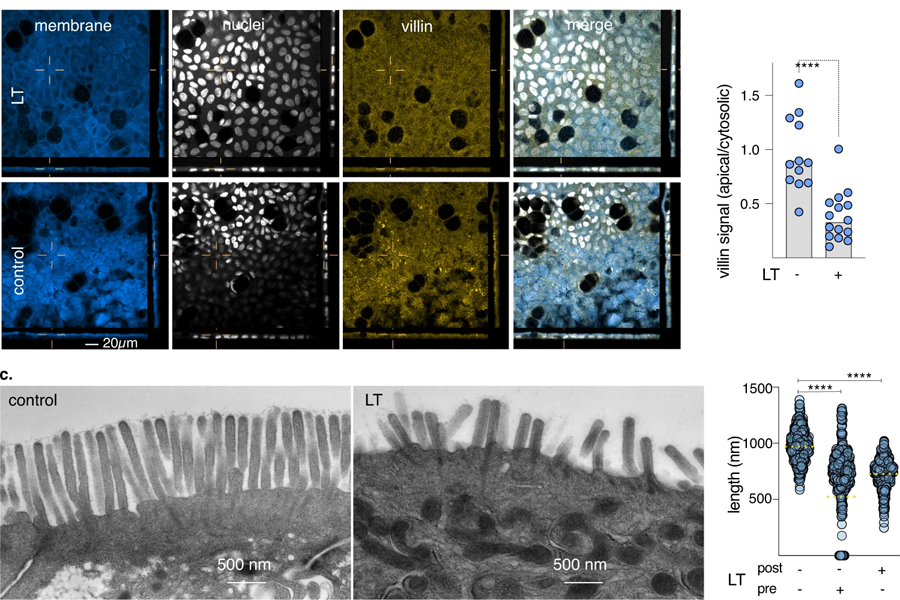 熱不穩(wěn)定毒素損害小腸微絨毛的有效形成