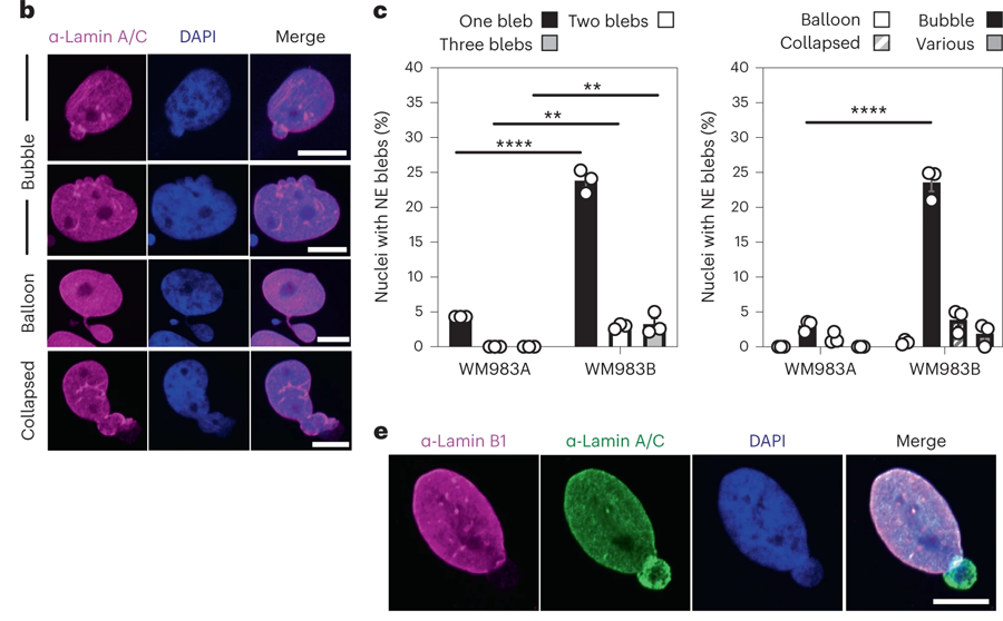 轉(zhuǎn)移性黑色素瘤細(xì)胞的NE(核包膜蛋白）是高度活躍的
