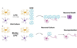 26年前發(fā)現(xiàn)的抗衰老蛋白可以對抗炎癥，避免神經(jīng)元死亡