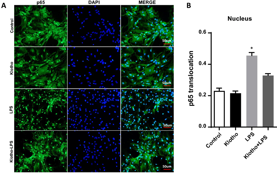 α-Klotho挽救核心區(qū)域由LPS誘導的NF-κB活化