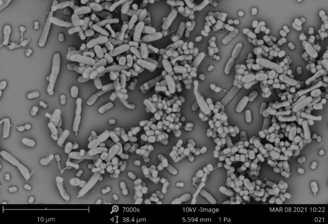 掃描電鏡顯示肺炎克雷伯菌和鮑曼不動桿菌在生物膜中共同生長