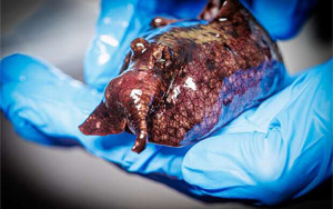 神經(jīng)信號調(diào)節(jié)新發(fā)現(xiàn)：L-或D-氨基酸？鏡像分子可改變神經(jīng)元的信號！