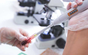 肌紅蛋白（MYO）檢測試劑盒用原輔料