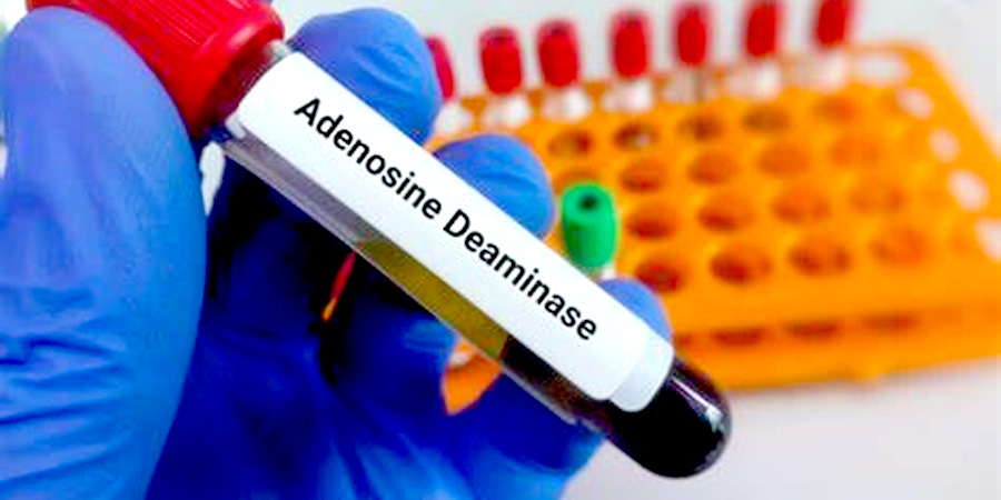 前蛋白檢測(cè)