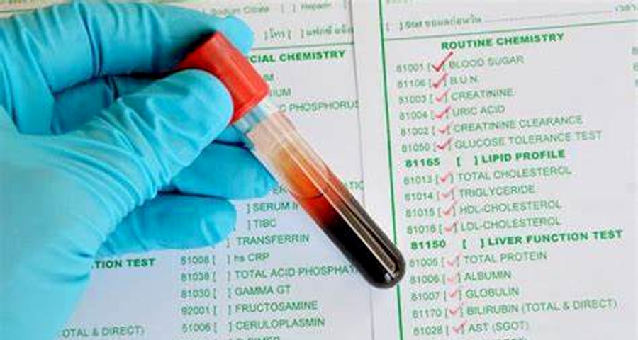 單胺氧化酶（MAO）檢測