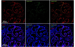 一種罕見基因突變，感覺不到疼痛！新研究揭示其獨特的分子機制