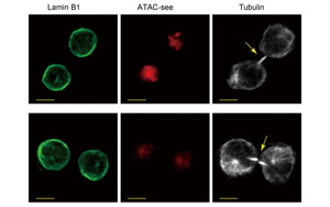 是什么決定了CD8+ T細胞的命運？Immunity新研究指向cBAF復(fù)合物