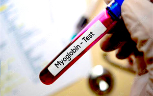 肌紅蛋白（Myo）-磁微?；瘜W(xué)發(fā)光（AE/AP） /熒光免疫層析解決方案