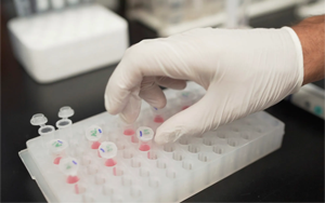 阿爾茲海默癥早期診斷標(biāo)志物