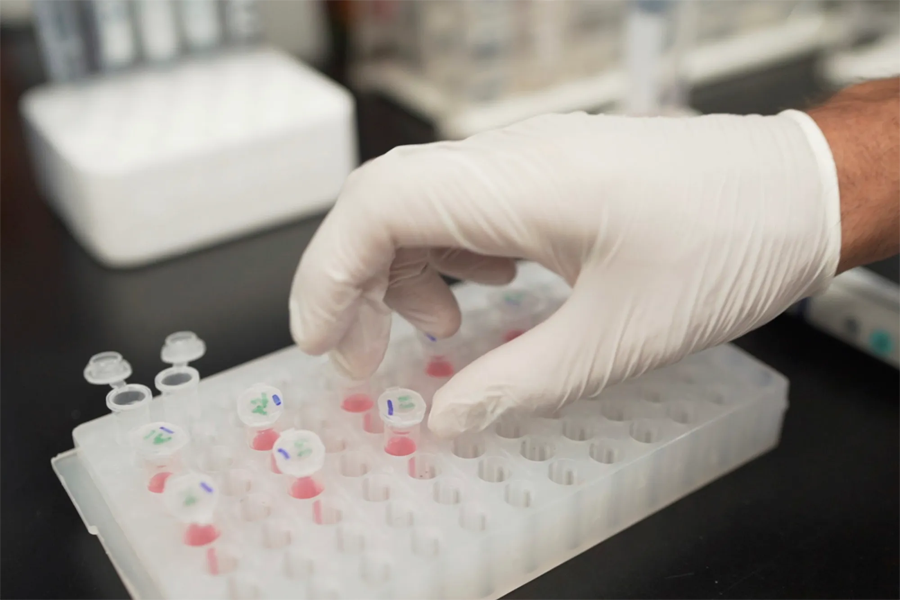 阿爾茲海默癥早期診斷標(biāo)志物