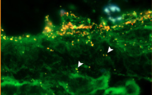 PNAS新研究：致病菌利用腸道黏液層中的一種糖來(lái)感染腸道