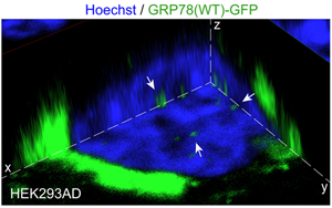 癌癥擴(kuò)散中伴侶蛋白是幫兇之一