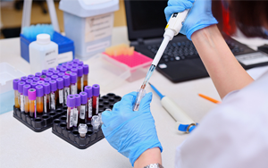 可溶性生長(zhǎng)刺激表達(dá)基因2蛋白（ST2）- 磁微粒化學(xué)發(fā)光法（吖啶酯）/熒光免疫層析解決方案