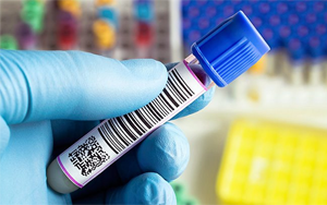 脂蛋白相關(guān)磷脂酶A2（Lp-PLA2）檢測(cè)原理及相關(guān)原料