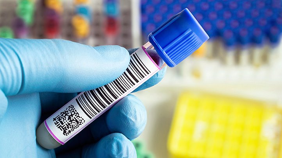 Lp-PLA2檢測 Lp-PLA2檢測