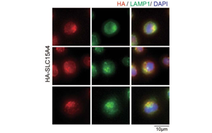 Nature子刊：開創(chuàng)性的將化學(xué)探針引入活細(xì)胞，靶向紅斑狼瘡