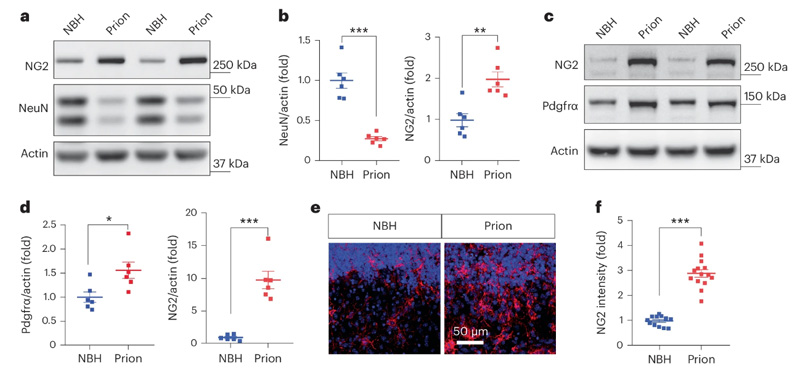 朊病毒疾病模型中NG2膠質(zhì)細(xì)胞的激活 朊病毒疾病模型中NG2膠質(zhì)細(xì)胞的激活