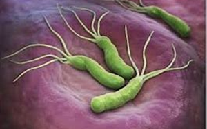 幽門螺桿菌(HP.CagA)-磁微?；瘜W(xué)發(fā)光法（AE/AP）解決方案